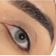 سكاي - عدسات ذهب