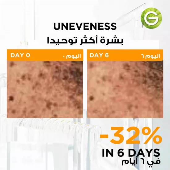 سكين اكتيف سيروم فيتامين سي %3 و نياسيناميد امبولة 1.5 مل - من قارنيه
