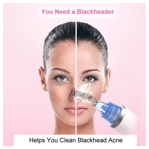 جهاز تنظيف الرؤوس السوداء جهاز تنظيف الرؤوس السوداء