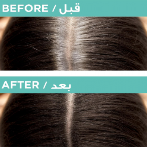 لوريال باريس ماجيك ريتوتش ، خافي عيوب فورية ، بني غامق لوريال باريس ماجيك ريتوتش ، خافي عيوب فورية ، بني غامق