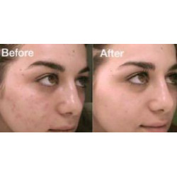 سيروم ألفا أربوتين 2% + Ha لمعالجه البقع والتصبغات من ذا اورديناري