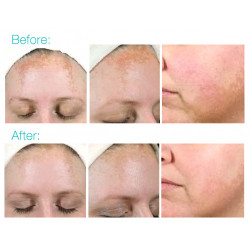 كريم تفتيح التصبغات والبقع الداكنه من بي اف بي فانيش