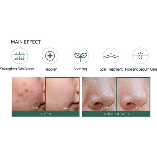 سوم باي مي كريم أحماض التقشير المعجزة - 60 جرام سوم باي مي كريم أحماض التقشير المعجزة - 60 جرام