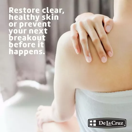 دي لا كروز مرهم الكبريت لعلاج حب الشباب 73.7جرام