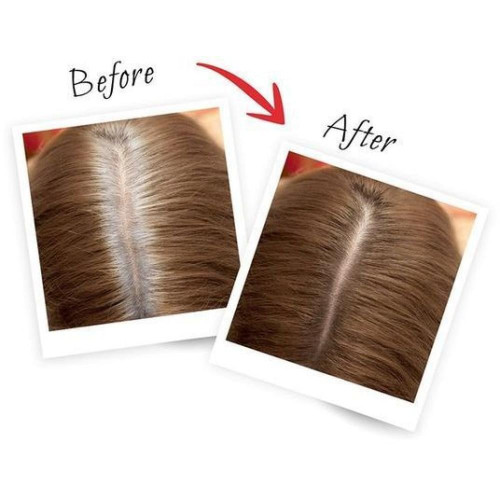 لوريال باريس ماجيك تاتش بخاخ صبغة شعر مؤقتة - بيج 75 مل