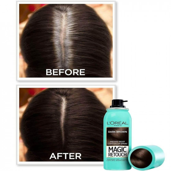 لوريال باريس ماجيك ريتوتش بخاخ صبغة شعر مؤقتة - بني داكن 75 مل