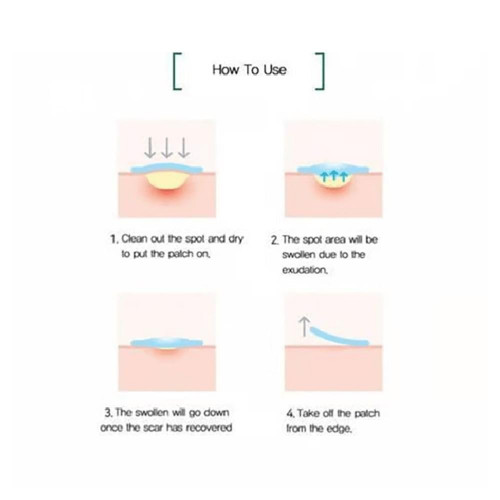 سوم باي مي لصقات المعجزة لعلاج الحبوب والآثار - 18 لصقة سوم باي مي لصقات المعجزة لعلاج الحبوب والآثار - 18 لصقة