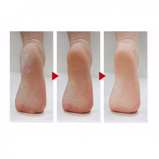 ام بيوتي جوارب القدم السحرية لتقشير القدمين باللافندر - 40 جرام