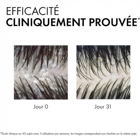 فيتشي ديركوس شامبو ضد القشرة للعناية بالشعر الجاف - 390 مل