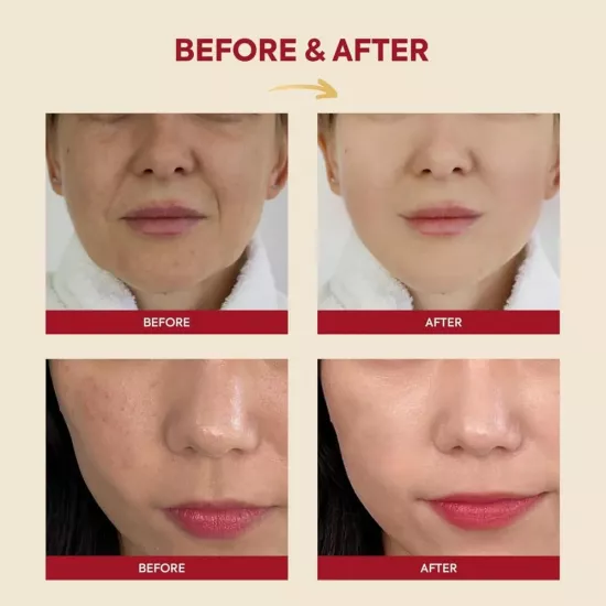 سيول 1988 خلاصة مخاط الحلزون 97 % والأرز لترطيب وتهدئة البشرة من كي سيكريت - 100 مل