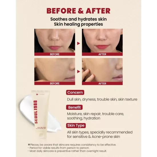 سيول 1988 كريم مرطب بمخاط الحلزون 93% والأرز من كي سيكريت - 100 مل