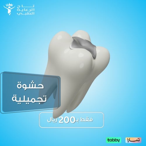 حشوة أسنان حشوة أسنان